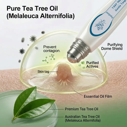 Pureluxo® Skin Tag Remover Roller💥