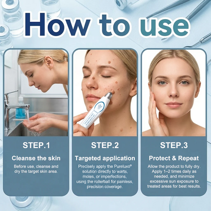 Pureluxo® Skin Tag Remover Roller💥