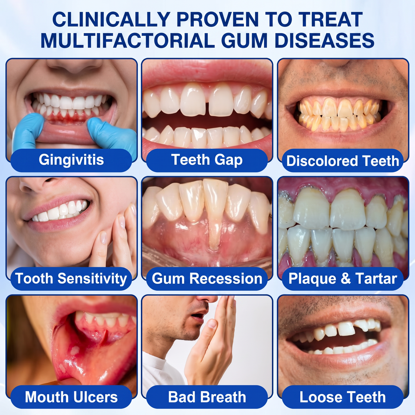 Pureluxo® 🦷GumRevive periodontal repair gel🌿