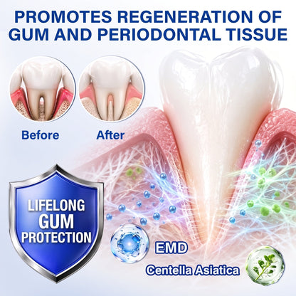 Pureluxo® 🦷GumRevive periodontal repair gel🌿