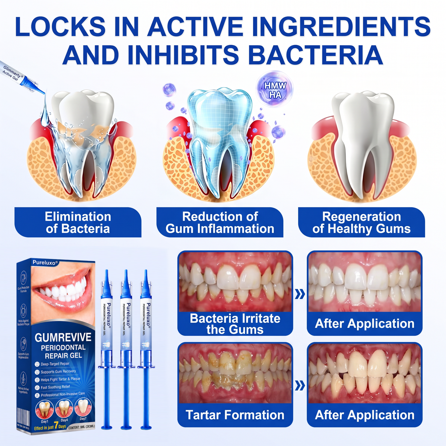 Pureluxo® 🦷GumRevive periodontal repair gel🌿