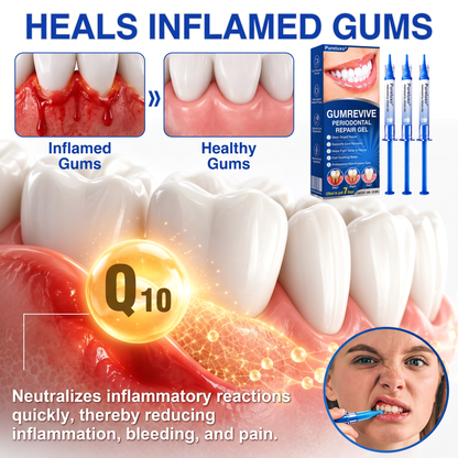 Pureluxo® 🦷GumRevive periodontal repair gel🌿