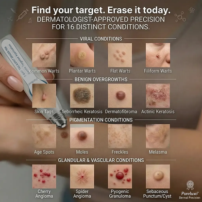 Pureluxo® Skin Tag Remover Roller💥